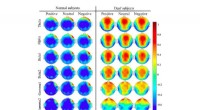 Novel EEG Brain Network Framework for Accurate Emotion Recognition in Deaf Individuals