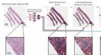 AI-Powered Virtual Staining Transforms Biopsy Images for Enhanced Diagnostic Accuracy
