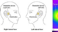 Human Body Communication in Binaural Hearing Aids: Advancing Signal Transmission Through the Head