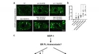 PC Deficiency Alters Seipin Function: Novel Insights into Berardinelli-Seip Congenital Lipodystrophy Type 2
