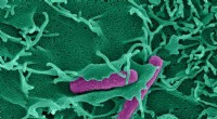 Physical Forces from Bacterial Infections Trigger Immune Response