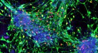 New Blueprint Converts Stem Cells into Sensory Interneurons