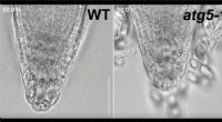 New Insights into Autophagy’s Role in Plant Cell Differentiation and Root Cap Detachment