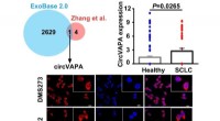 Circular RNA Drives Small Cell Lung Cancer Progression: New Mechanistic Insights