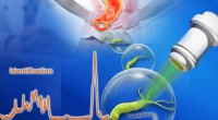 New Diagnostic Tool Promises Faster, More Accurate Detection of Cancer-Linked Stomach Bacteria