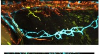 Lymphatic Origins of Blood Vessels: A Key to Vascular Development
