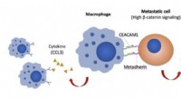 Novel Macrophage Mechanism Drives Ovarian Cancer Metastasis | HKU Research