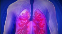 Drug-Resistant Mold Spreading from Environment to People s Lungs - Imperial College London Study