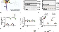 ST6Gal-I and Cancer Cell Invasion: A Mechanistic Link via EGFR Modulation