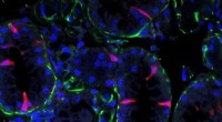 Ionocytes: A Novel Cell Type Holds Promise for Salivary Gland Restoration & Cystic Fibrosis Research