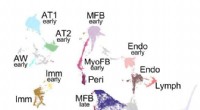 Postnatal Lung Development Atlas: A First Look at Lung Cell Evolution