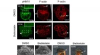 Myosin II Essential for Larval Shell Formation in Patellogastropods