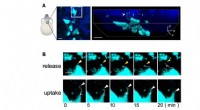 Advanced Microscopy Reveals Bone Remodeling Processes