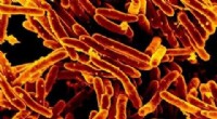 Understanding and Predicting Tuberculosis Drug Resistance