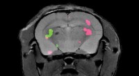 Revolutionary MRI Technique Maps Gene Expression for Potential Cancer & Stem Cell Tracking