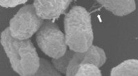 New Gene Discovered: Key to Antibiotic Resistance in Deadly E. coli