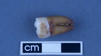 Ancient Teeth Reveal Origins of Early South Australian Colonists