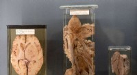 Vienna Natural History Museum Faces Ethical Questions Displaying Human Remains