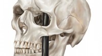 Phineas Gage:het ongeluk dat de moderne neurowetenschappen lanceerde 