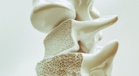 Estudo inovador descobre medicamento direcionado ao gene que pode reverter a osteoporose 