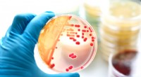 Medición del crecimiento bacteriano en placas de Petri:una guía paso a paso 