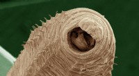 Sob as lentes:por que as minhocas parecem perturbadoramente complexas em detalhes microscópicos 